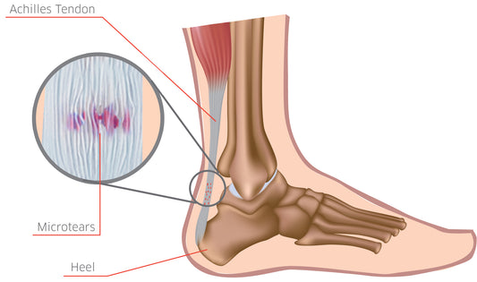 How to Strengthen Your Achilles Tendon